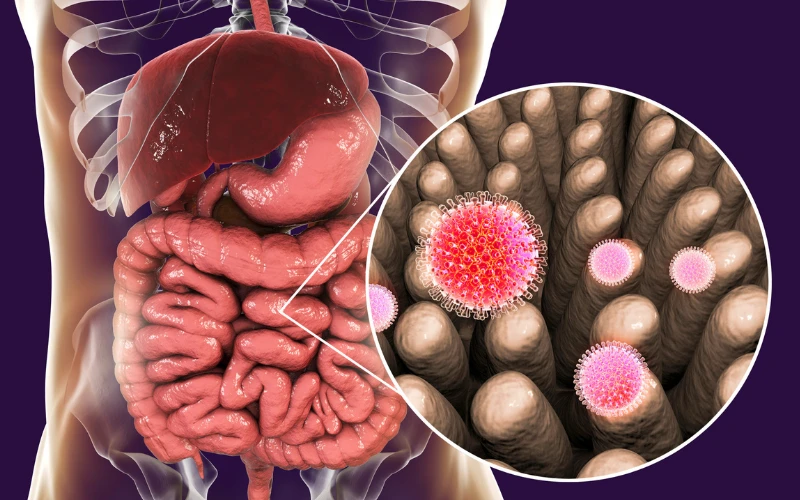 Amipli Dizanteri Nedir? Amipli Dizanteri İshal Kaç Gün Sürer?